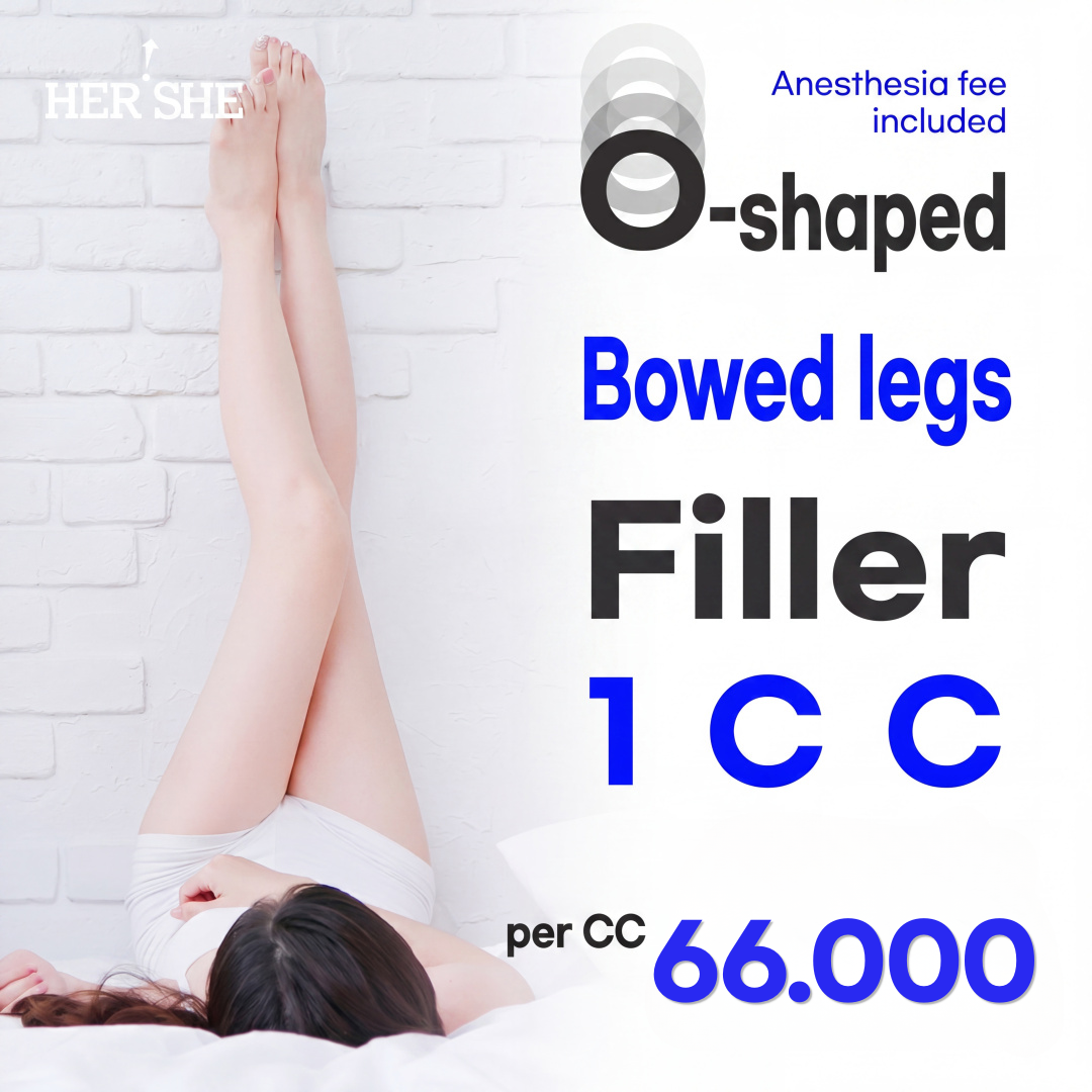 Leg Gap Closing Leg Filler