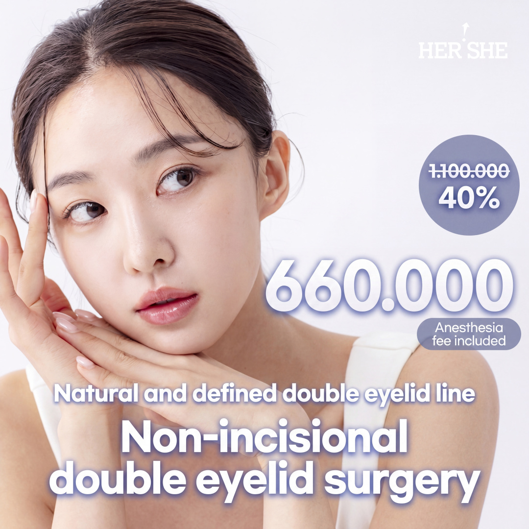 Double Eyelid Buried Suture, For Those Preferring In-Out Line