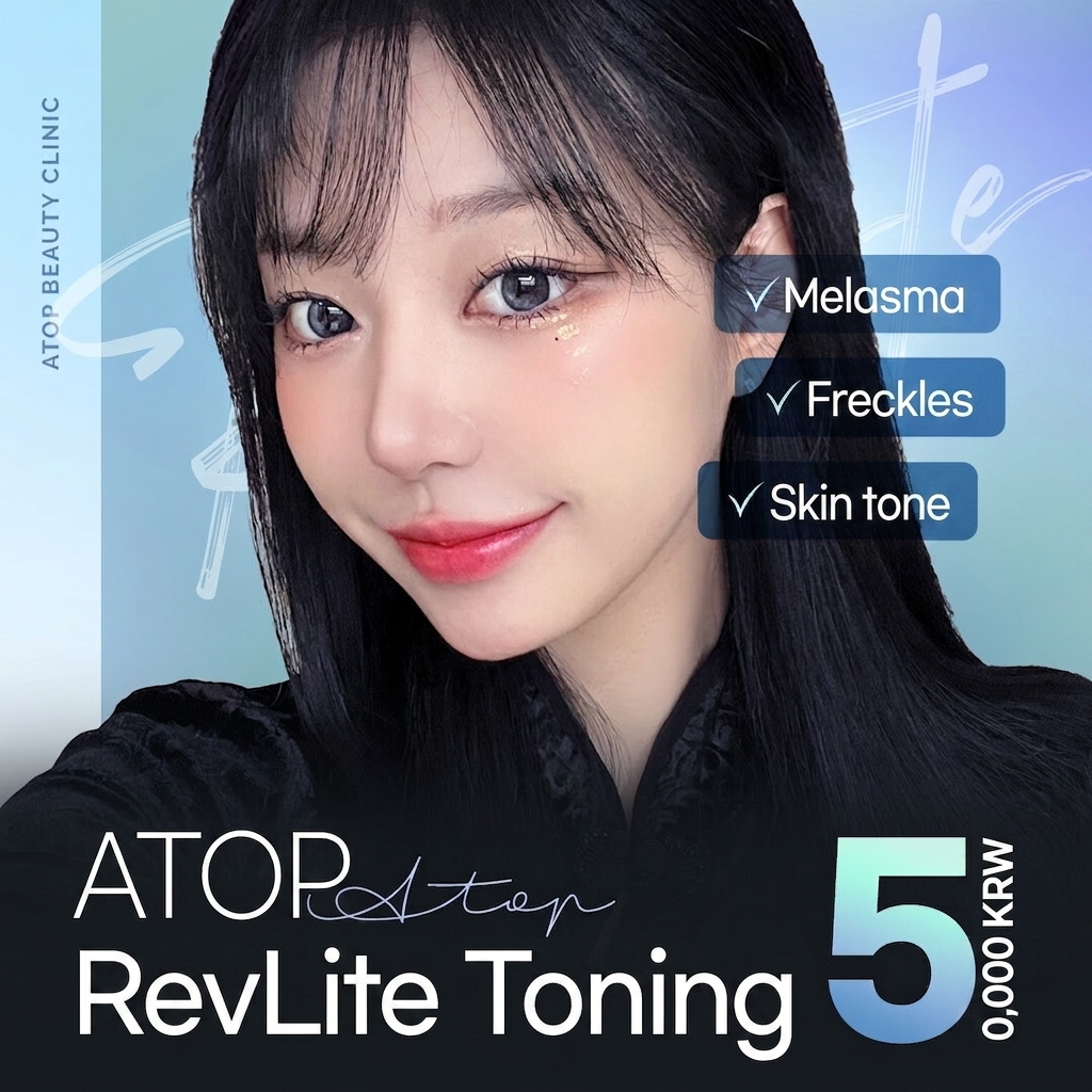 Laser Toning Revlite_Melasma Blemish, Freckle, Pigmentation Improvement