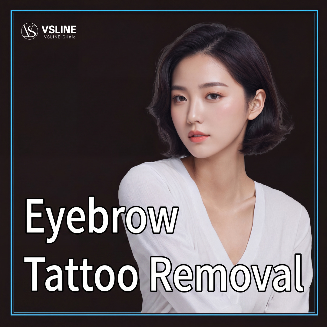 Ilsan Eyebrow Tattoo Removal