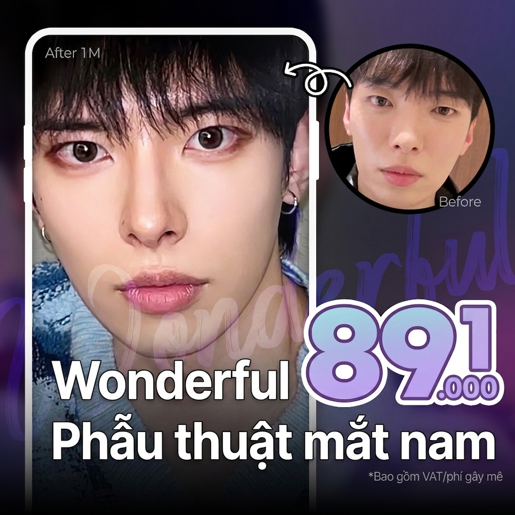 Wonderful_Thẩm mỹ mắt nam giới