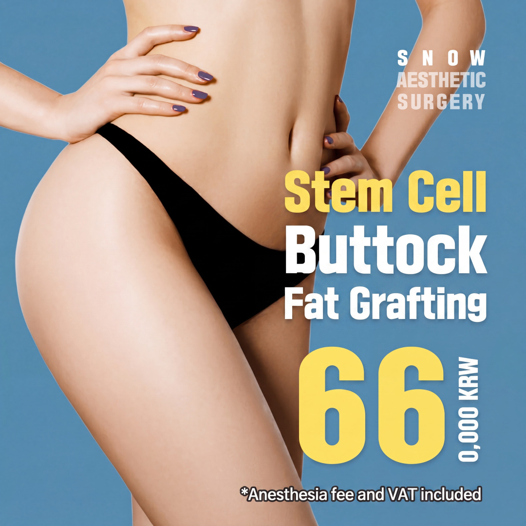 Stem Cell Hip-Up Buttock Fat Grafting