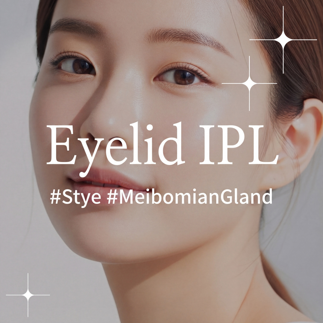 Eyelid IPL