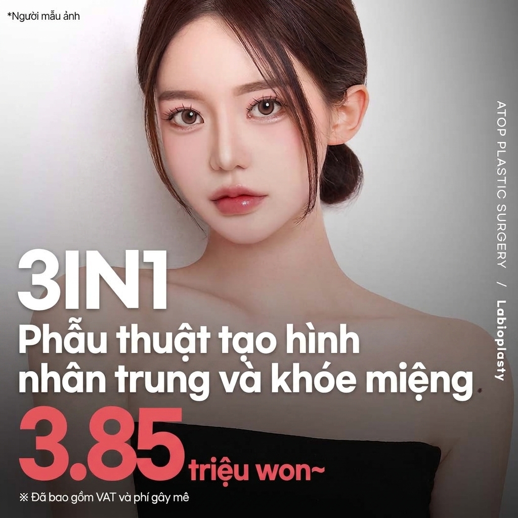 Atop Tạo hình nhân trung khóe miệng_Thu gọn nhân trung, Phẫu thuật khóe miệng_Hiệu quả thu gọn trung mặt