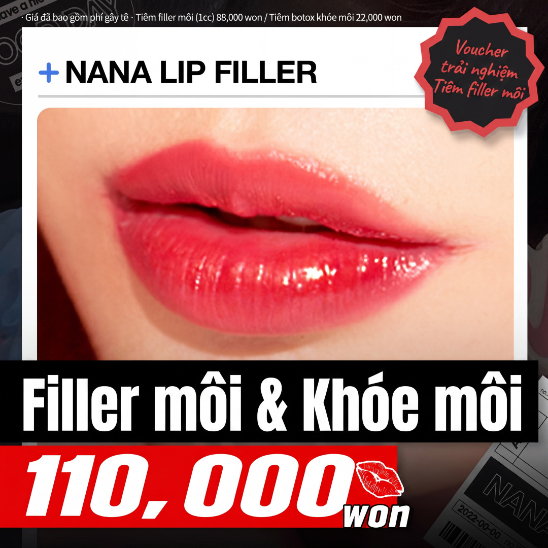 Nana_Filler môi & Botox khóe môi