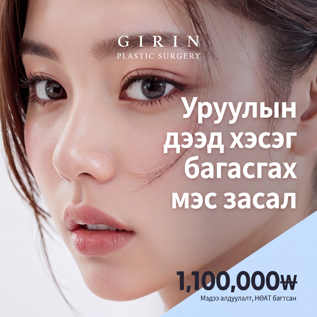 Girin Хамрын доод хонхорхой засах, багасгах, гүнзгийрүүлэх, C-Curl шугам, уруулын булангийн мэс засал, уруул хэлбэржүүлэх