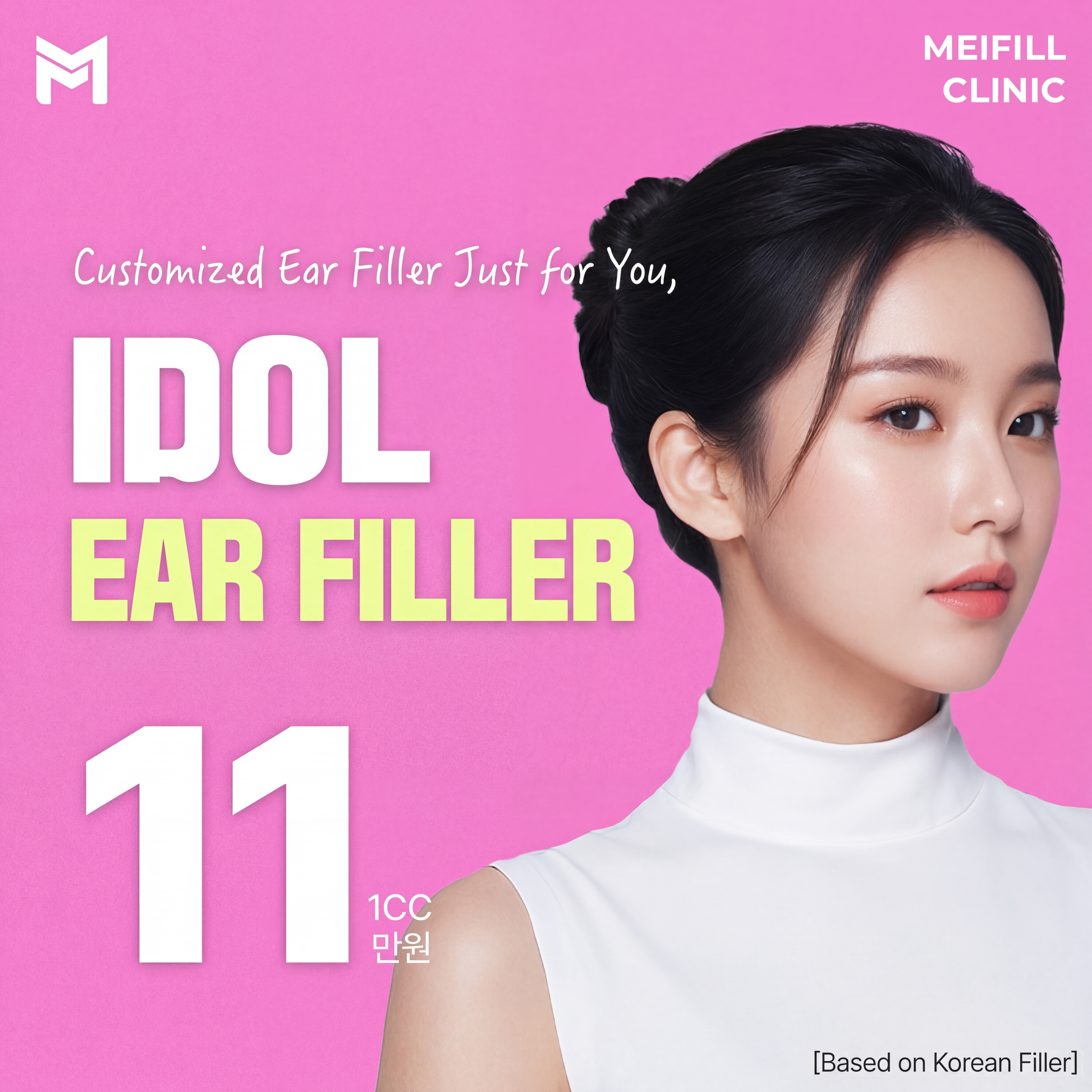 Trendy These Days, Idol Ear Filler - Elf Ear, Fairy Ear, Tinkerbell Ear, Idol Ear, Lying Ear, Knife Ear, Earlobe Filler, Ear Surgery