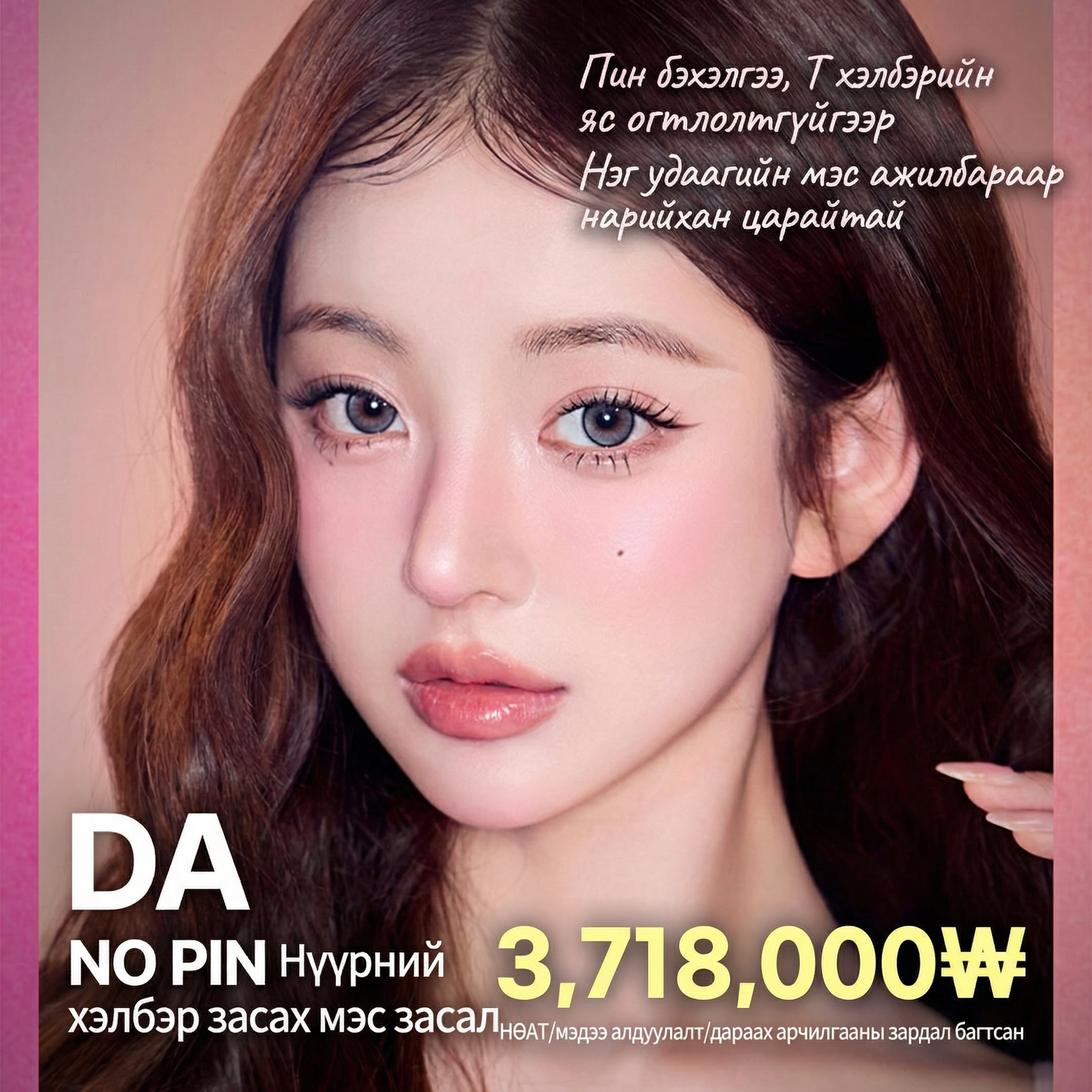 DA No-pin (Бэхэлгээгүй) нүүрний хэлбэр - Дөрвөлжин эрүү, эрүүний үзүүр
