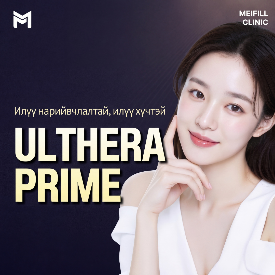 Ултерапи Прайм 100 шот - Лазер лифтинг, Ултера лифтинг шинэчлэл, давхар эрүү, эрүүний өөх, эрүүний доод өөх, давхар эрүү, эрүүний шугам, V-лайн, арьсны уян хатан байдал сайжруулах, Ултера