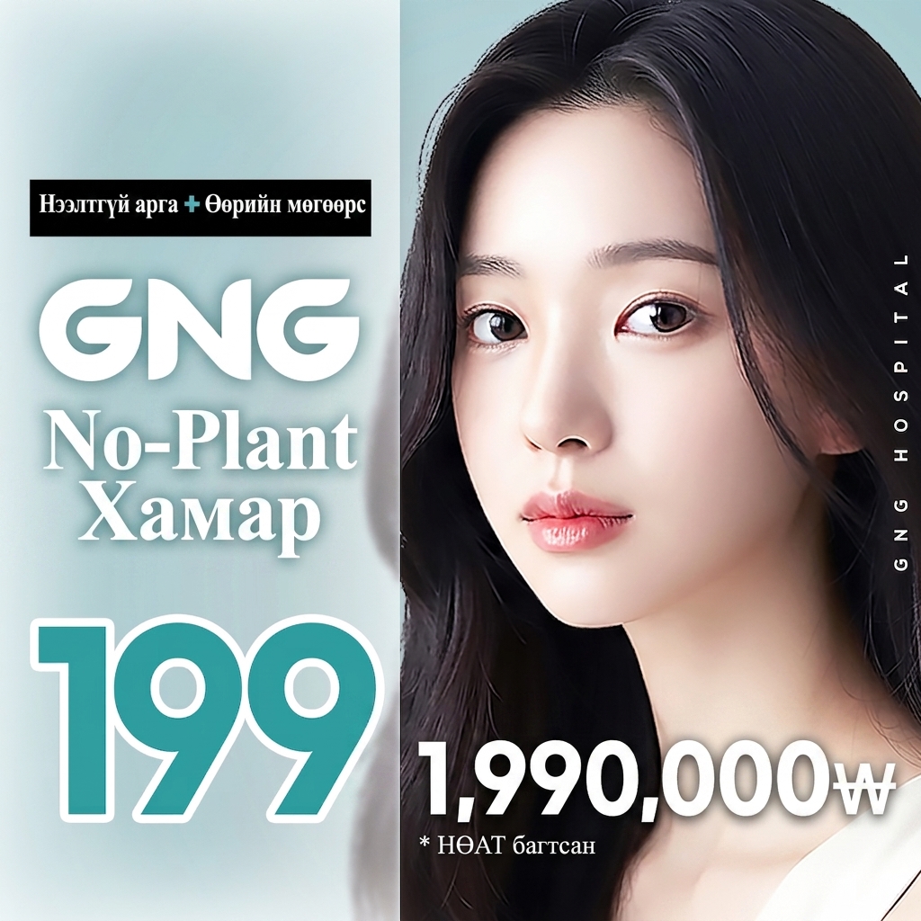 GNG No-Implant битүү хамрын мэс засал