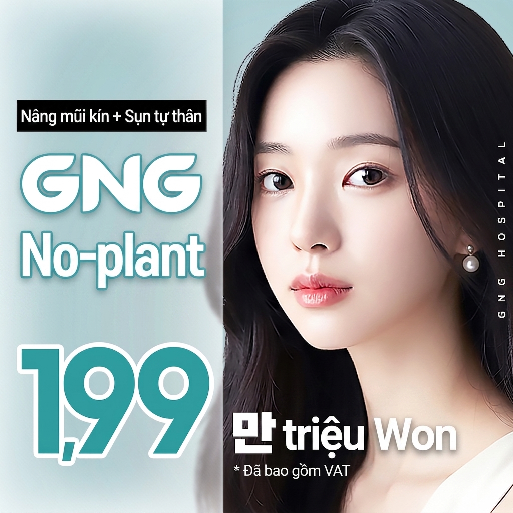 GNG Nâng mũi không đặt sụn không rạch