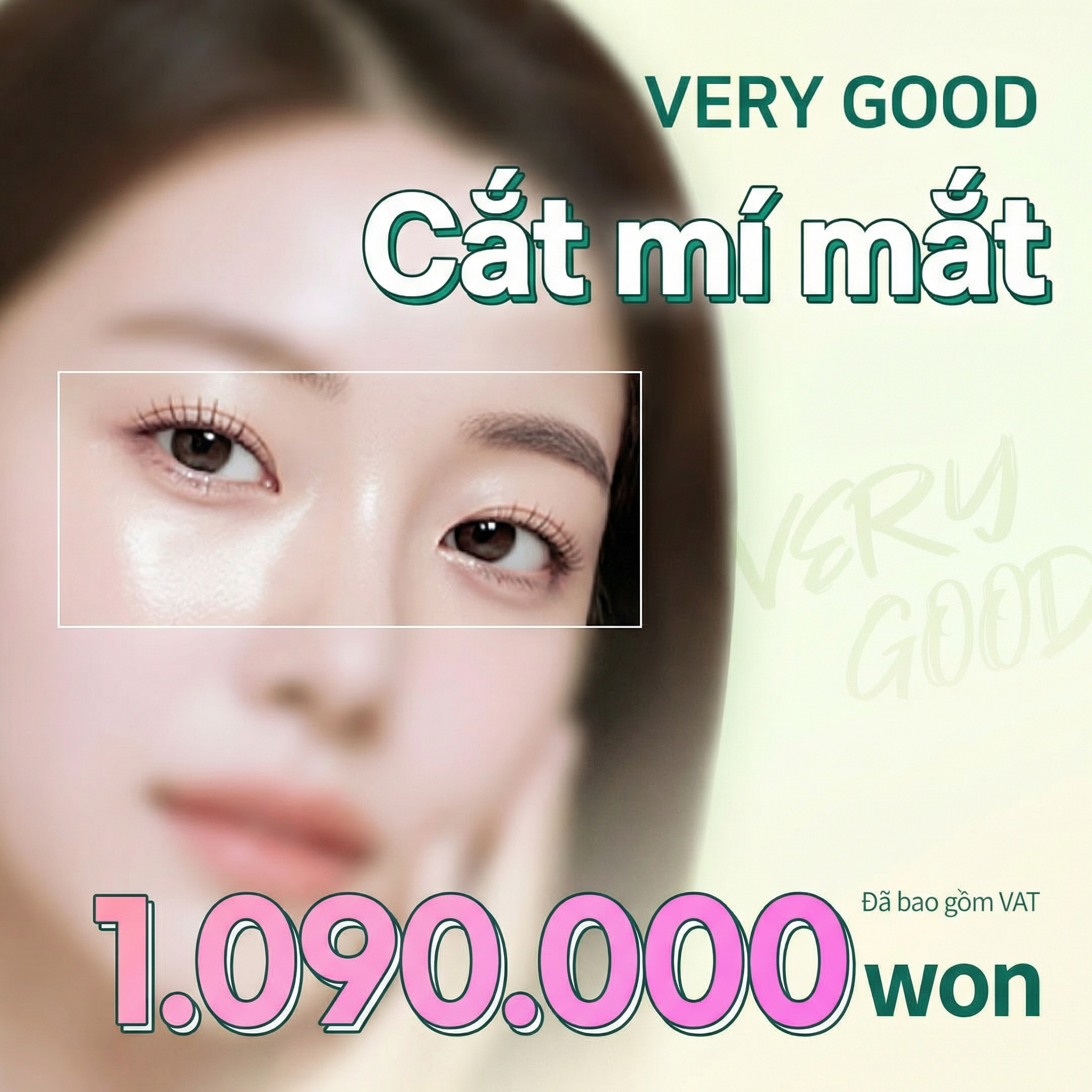 Cắt mí toàn phần