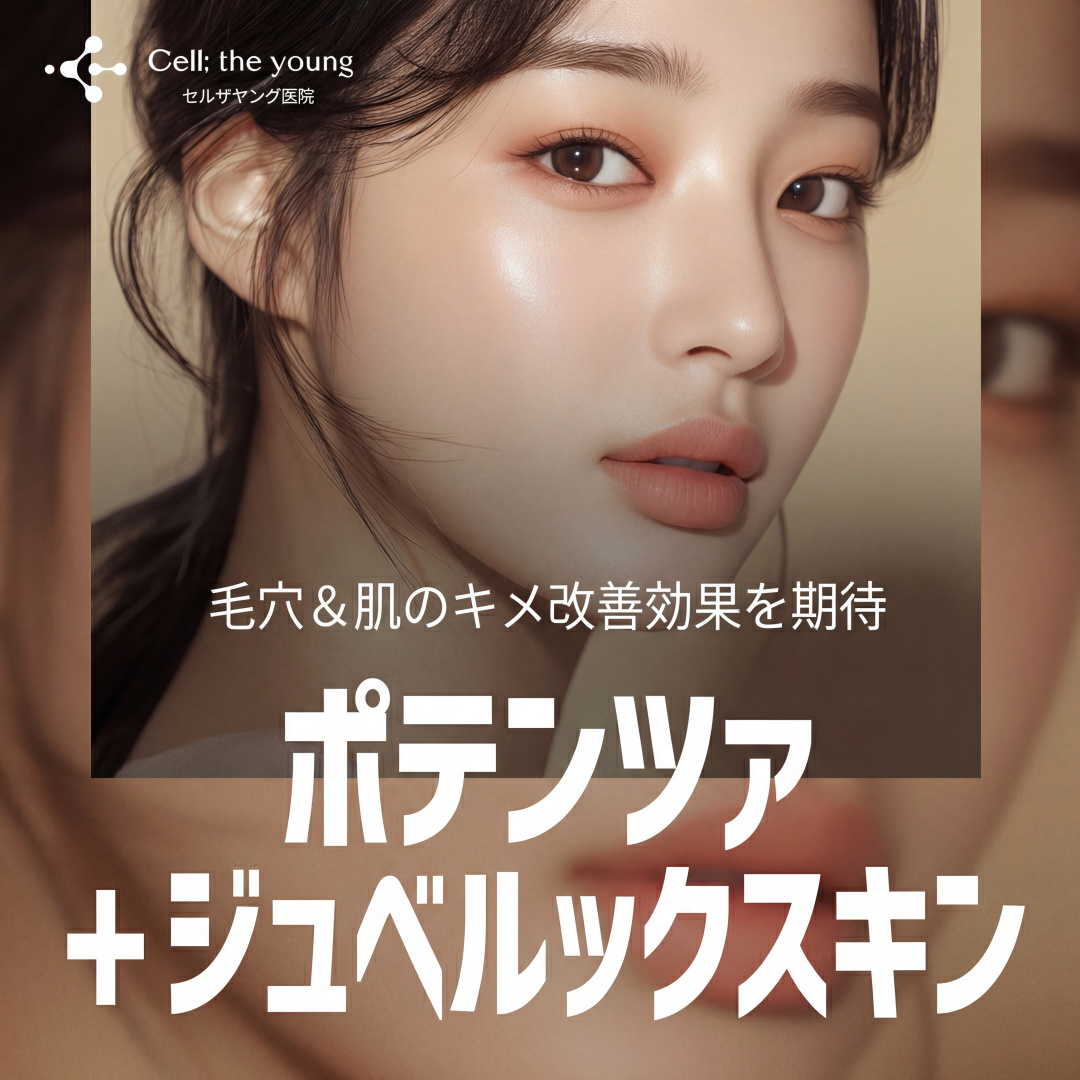 셀더영 포텐자