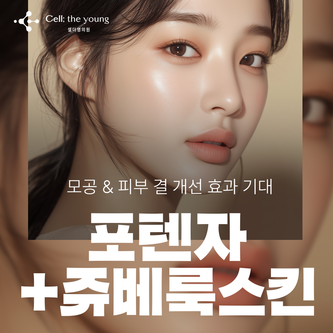 셀더영 포텐자