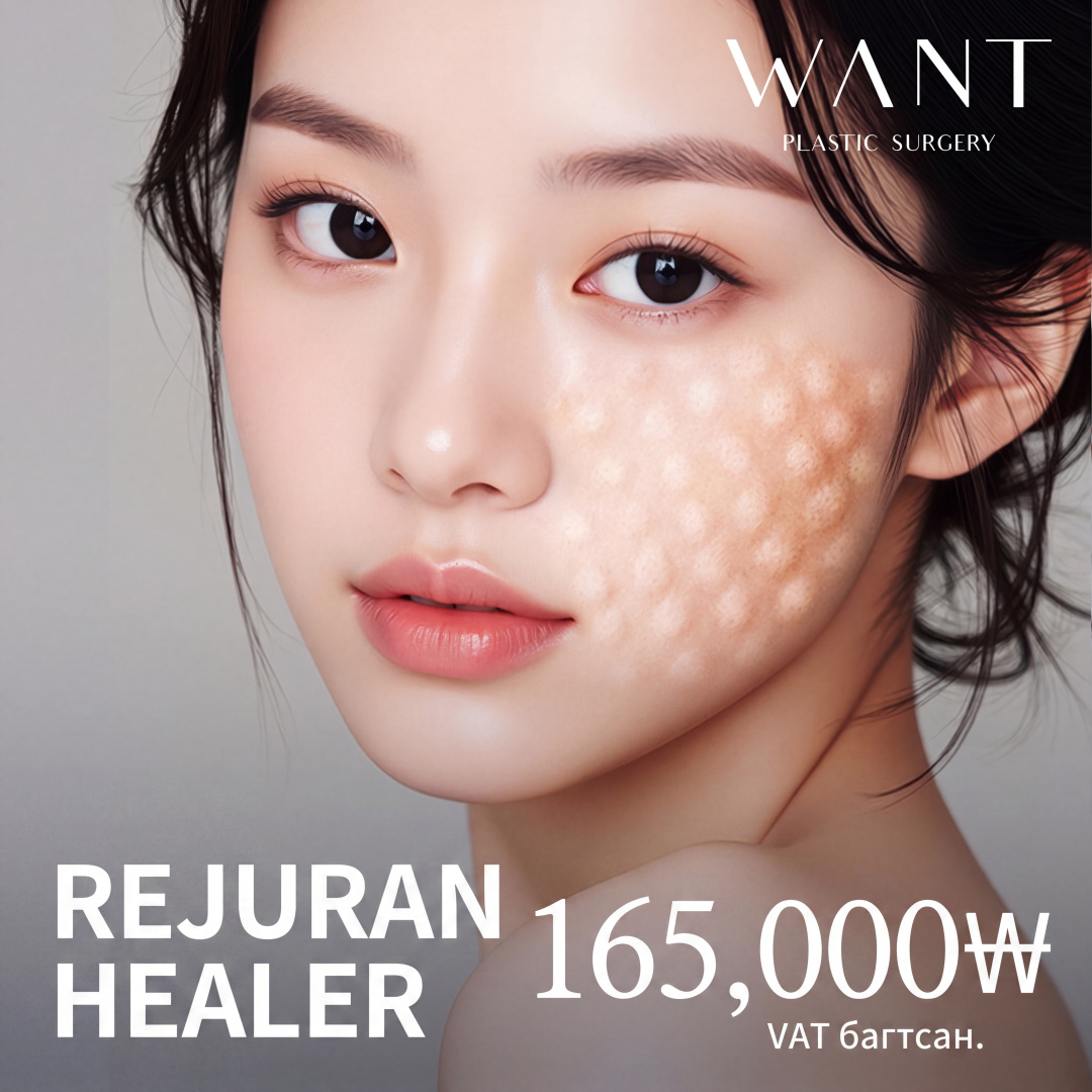 원트 리쥬란힐러