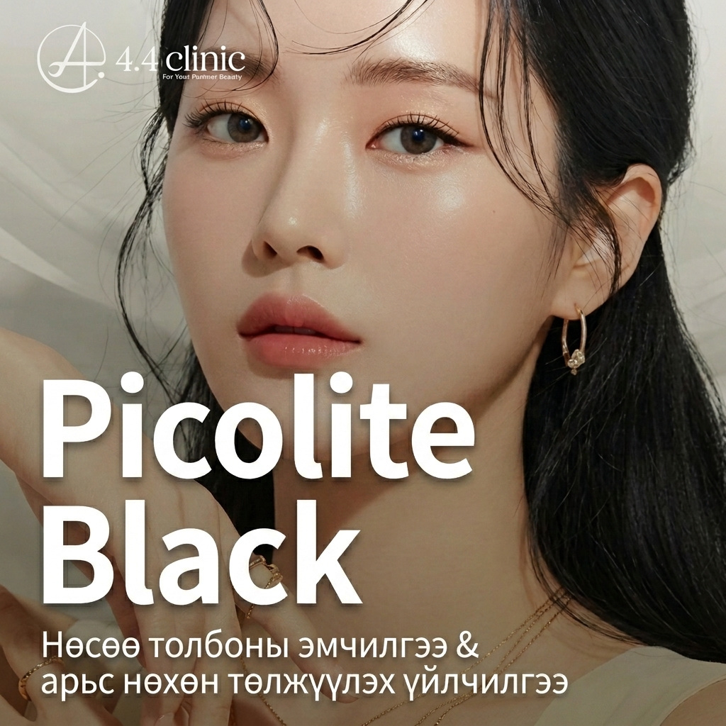 4.4의원 피코라이트 블랙 토닝 레이저