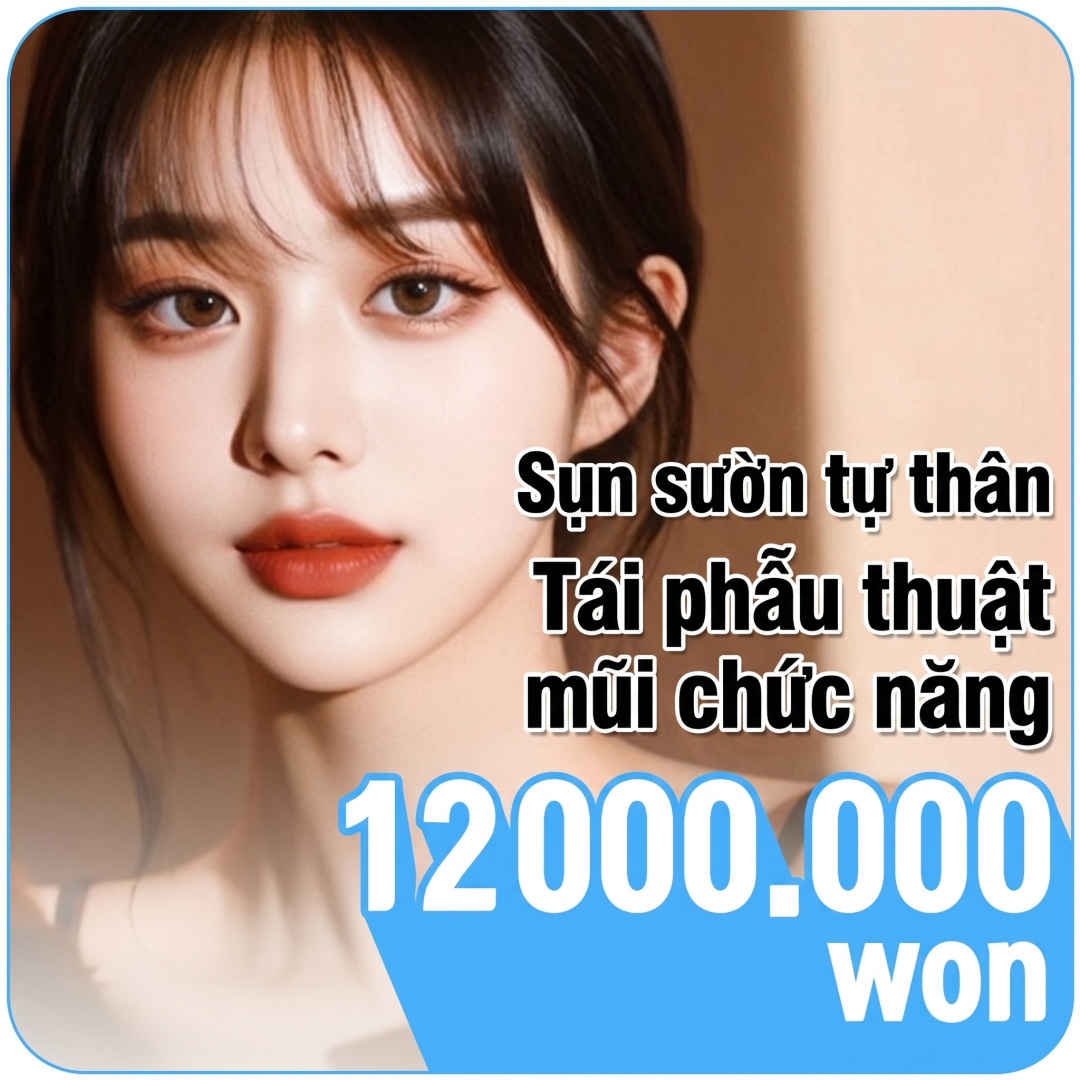 Sửa mũi lại chức năng sụn sườn tự thân