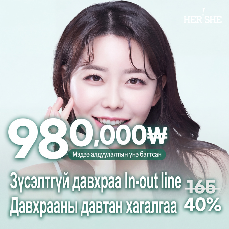 Нүдний давтан мэс засал Оёдолтой давхраа, In-Out хэлбэрээр байгалийн мэт