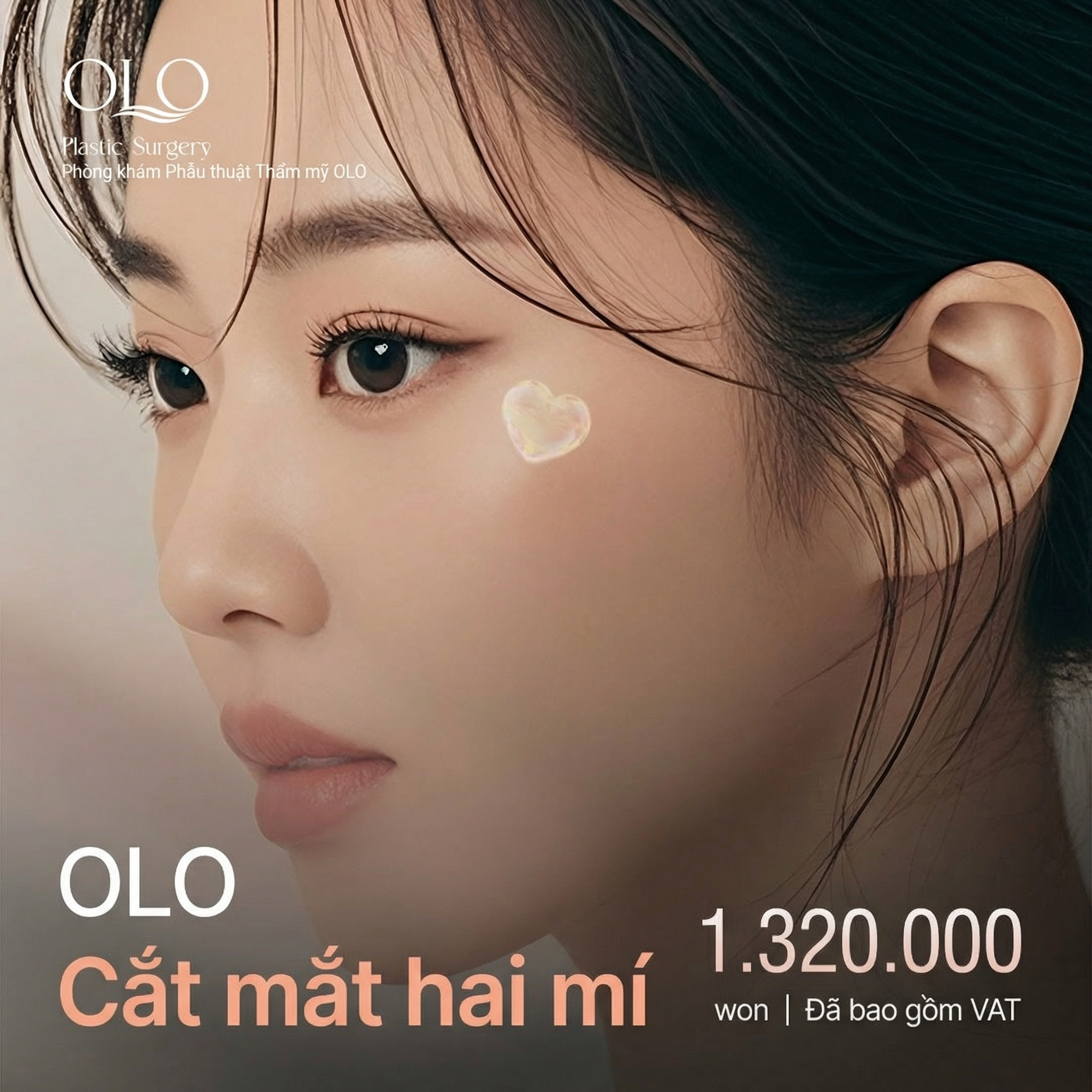 Olo Cắt mí toàn phần