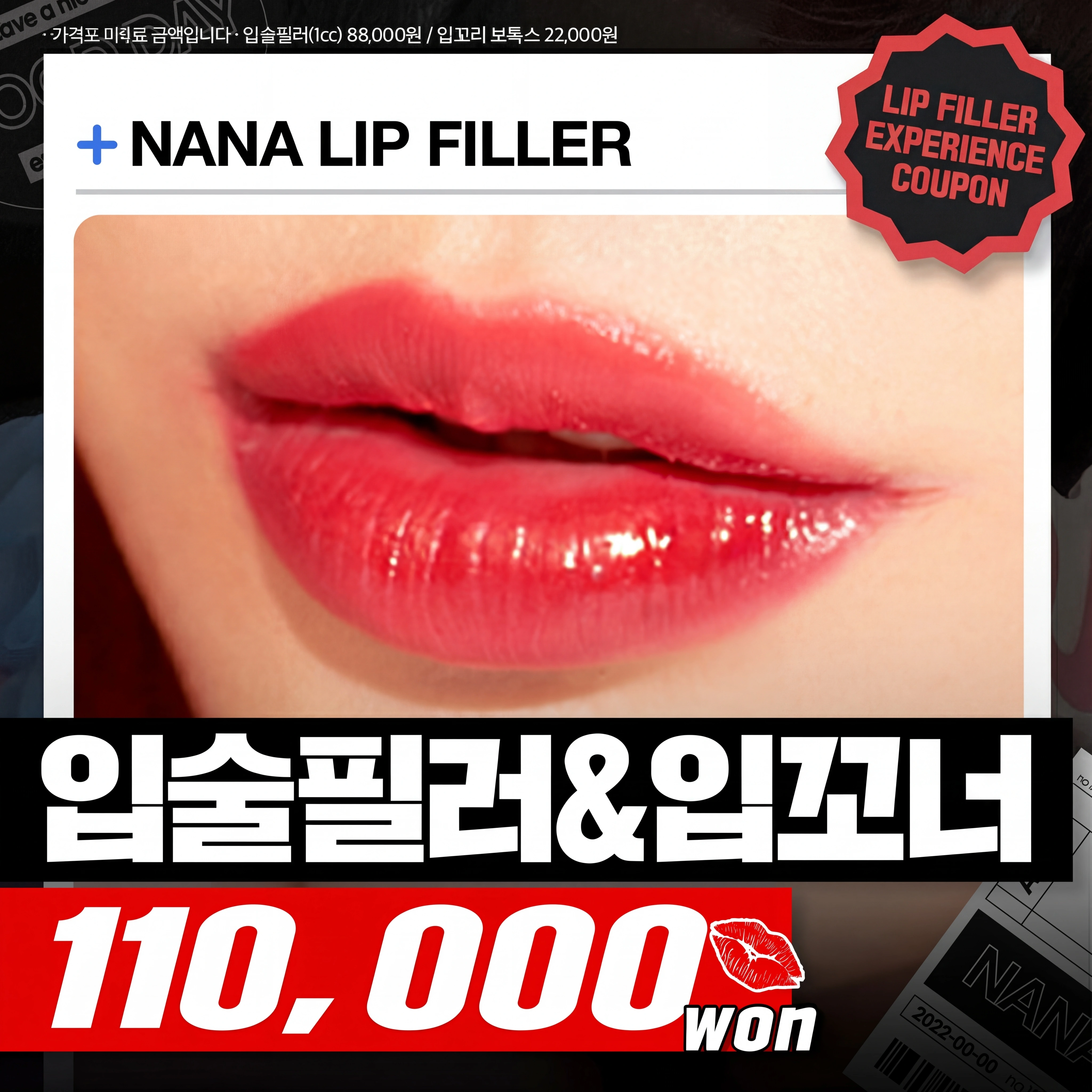 Nana Lip Filler & Lip Corner Botox