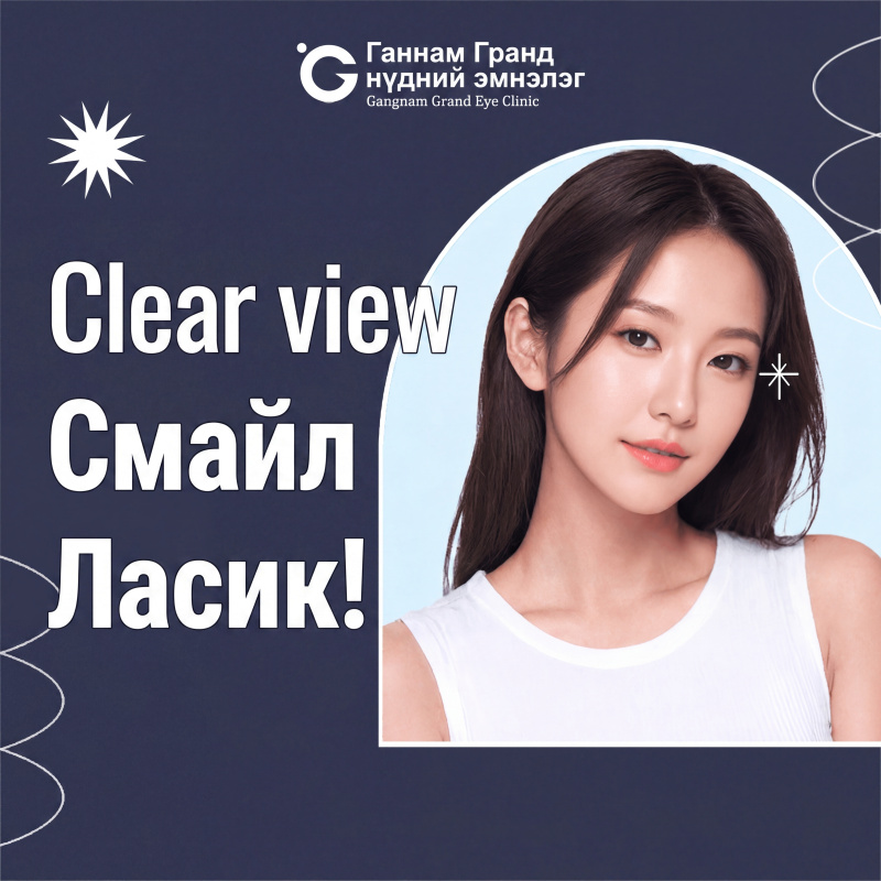 4-р үеийн Clear View Smile Lasik