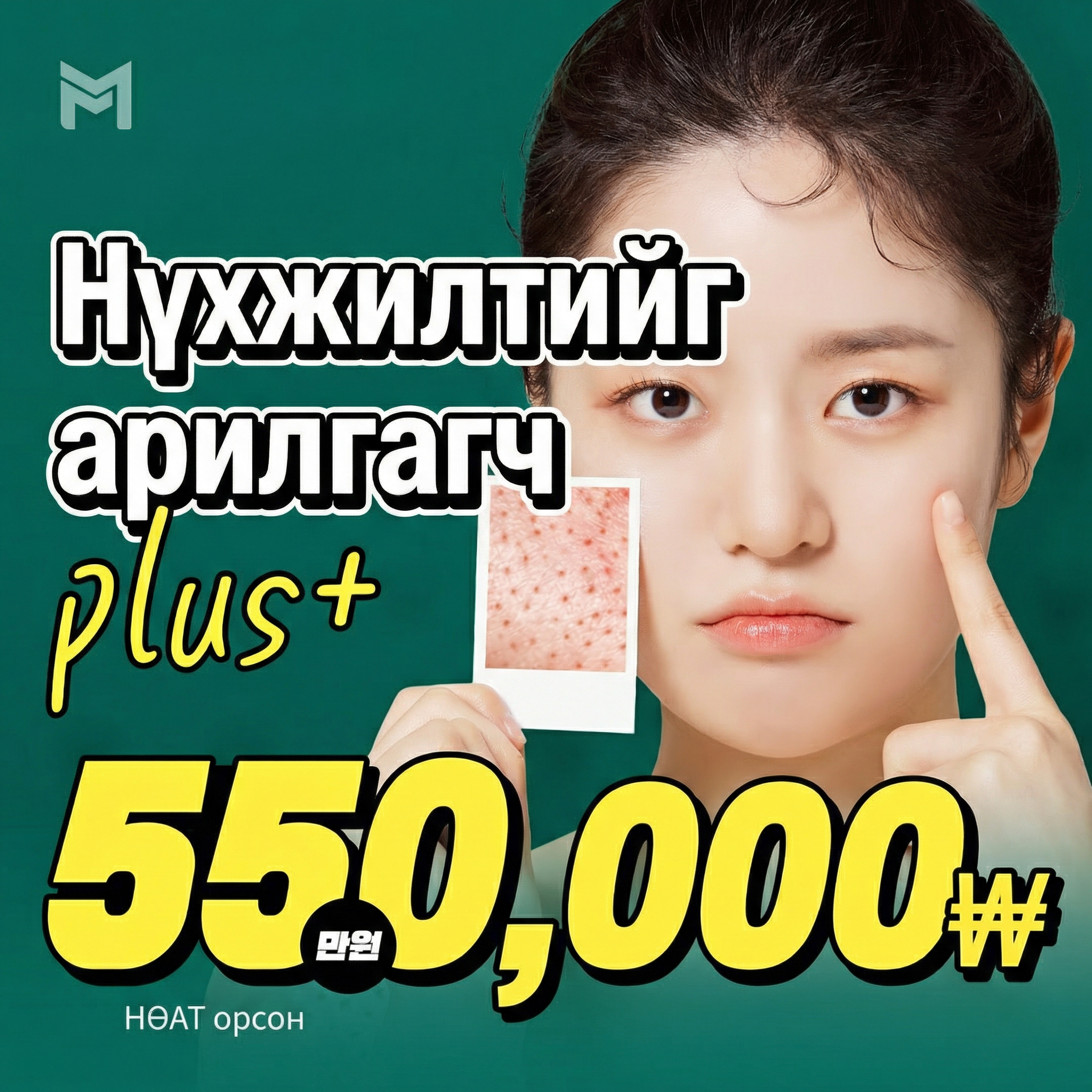 Potenza Laser & Juvelook Нүхжилт арилгагч - Нүхжилт агшаах, Арьсны бүтэц, Арьсны өнгө, Нарийн үрчлээ сайжруулах. Скин бүүстер сонгох боломжтой