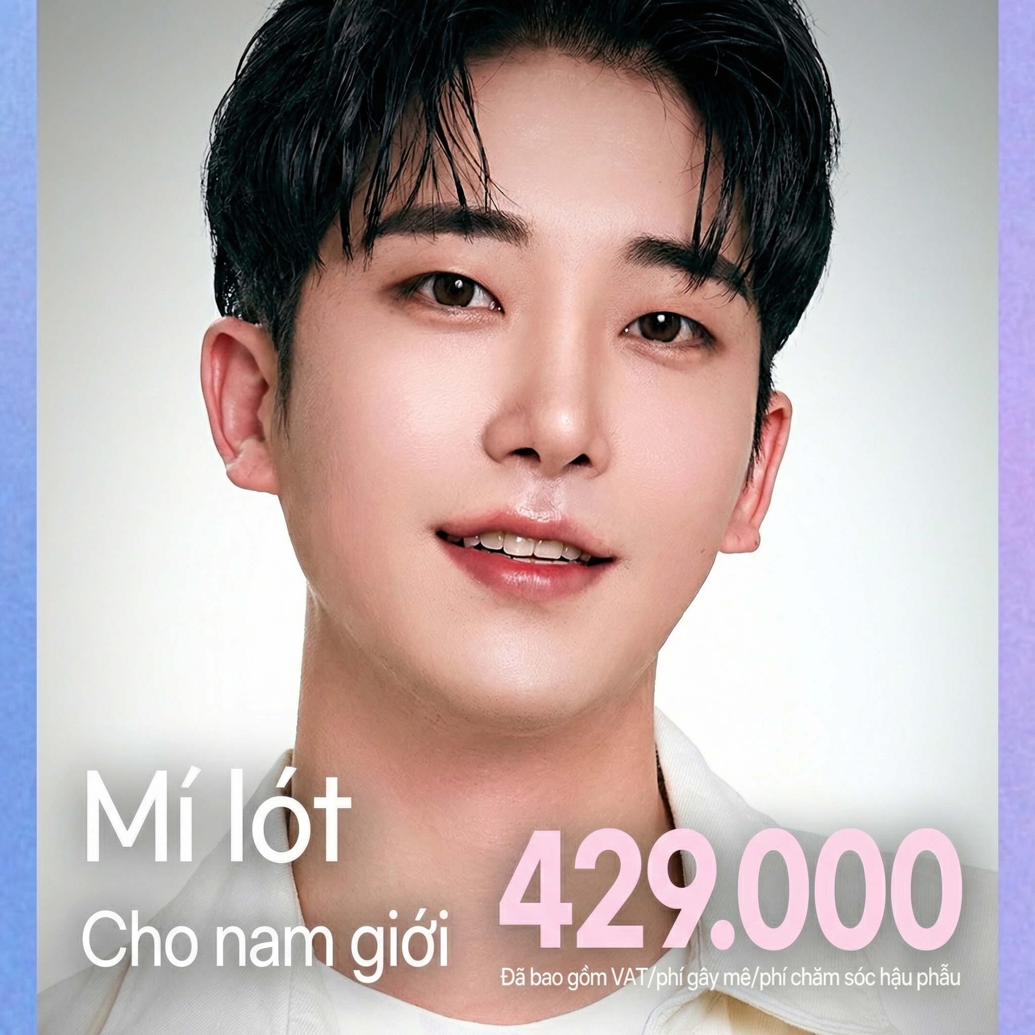 Mắt nam cũng là DA_Nam Semi-Không mí_Chỉnh cơ nâng mi Cắt mí Tái phẫu thuật mắt Mở góc mắt trong ngoài