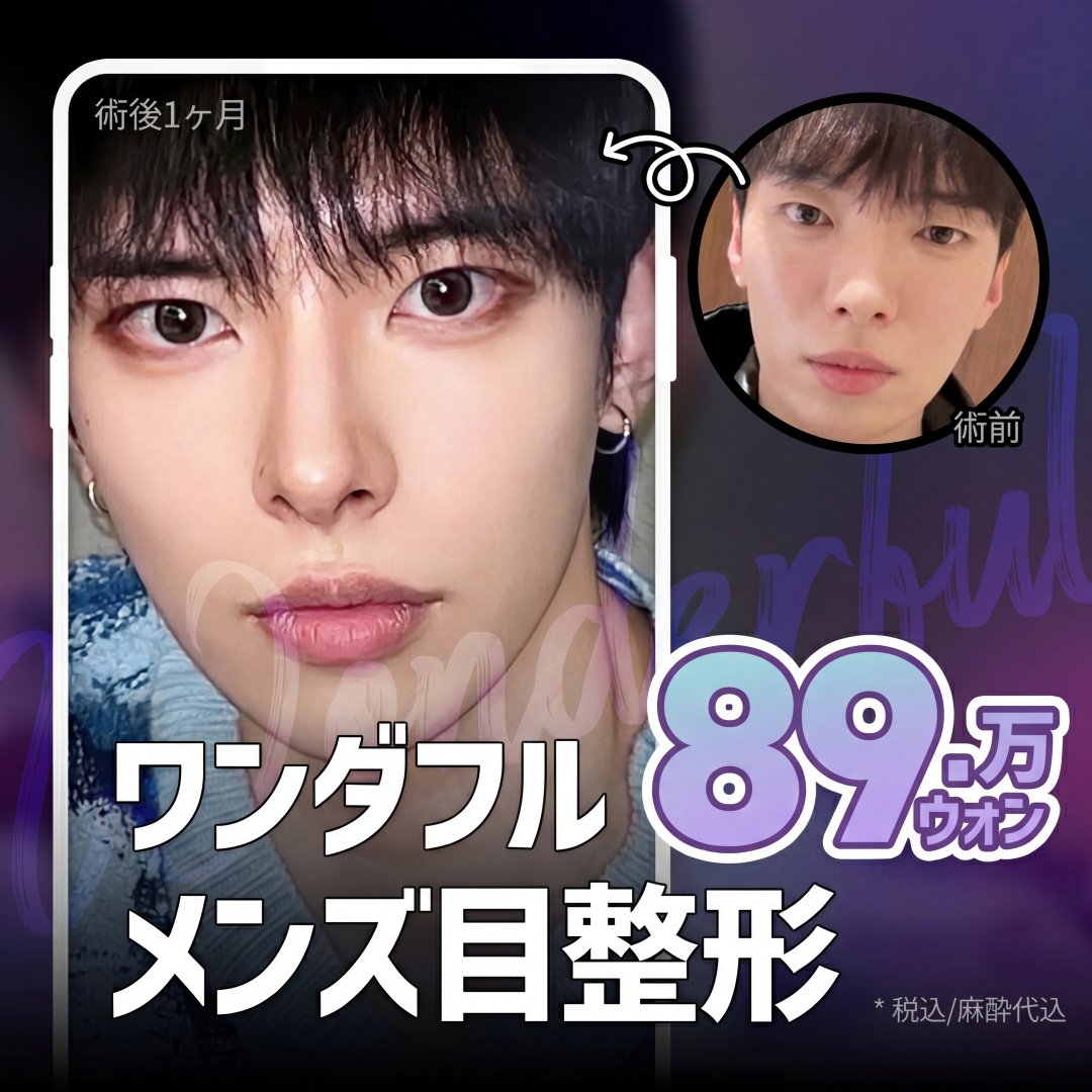 ワンダフル_男性目整形