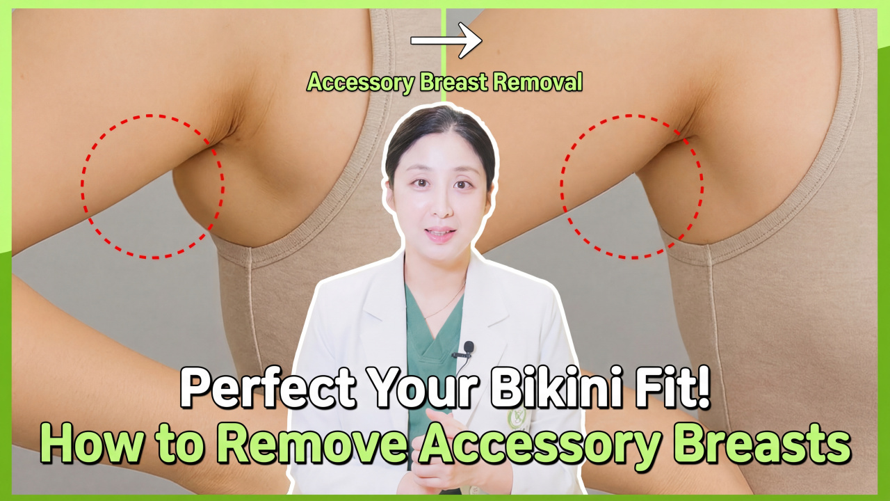 Listening to a Breast Specialist | How Much Do You Know About Accessory Breasts?
