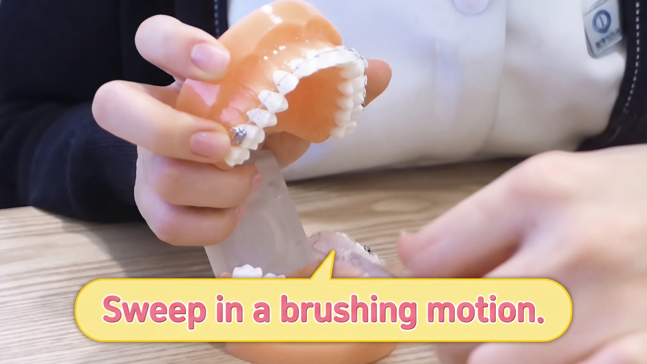 How to Brush Your Teeth Properly with Braces