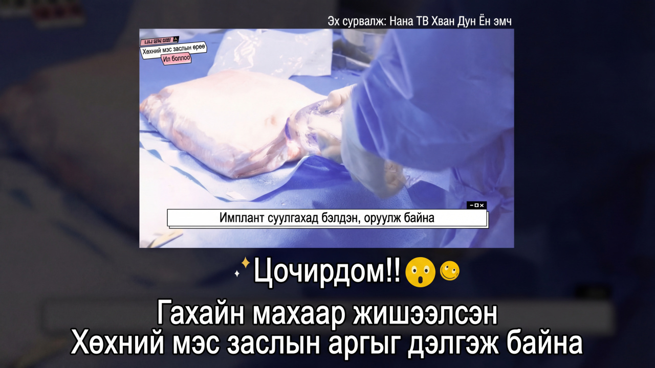 video