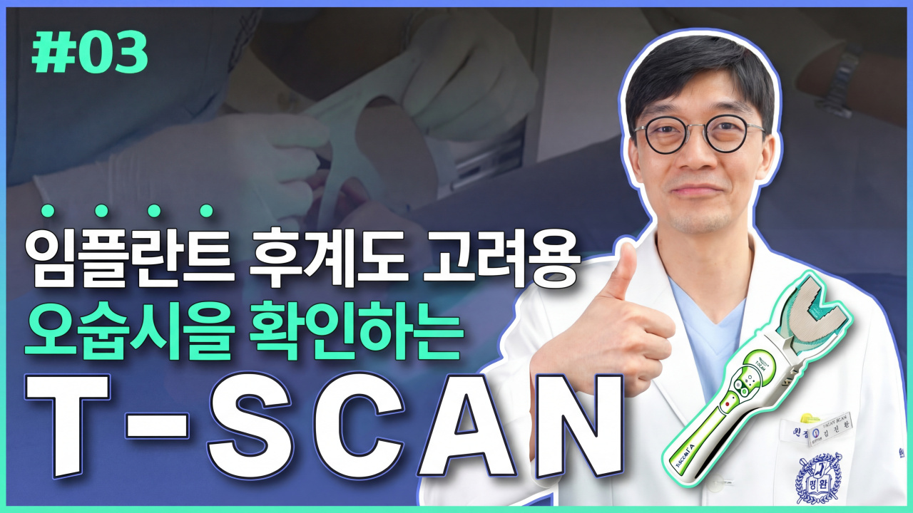 "T-Scan": Checking Occlusion Considering Post-Implant Care
