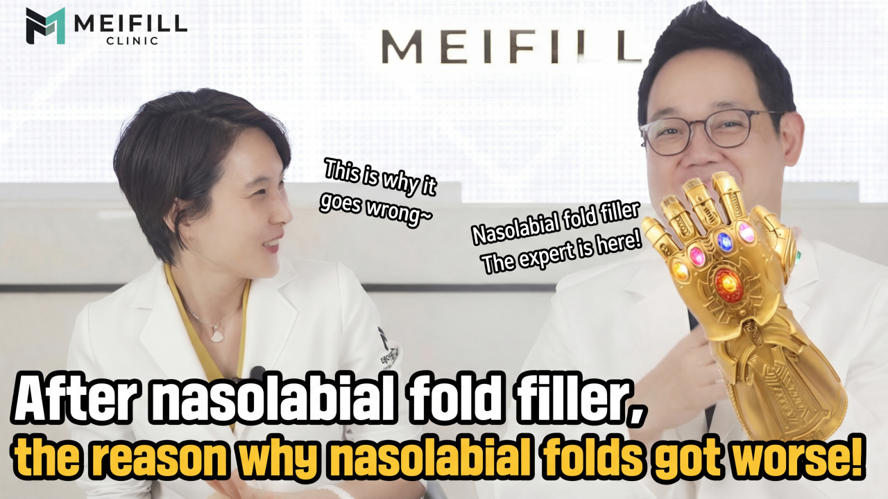 Getting Rid of Smile Lines: Is Filler & Lifting the Best Combo?