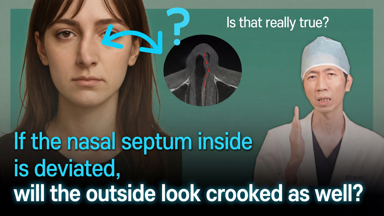 If I have a deviated septum, is my nose crooked? #GNGHospital #DrHongSeongMun